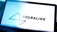 Neuralink разработва роботизирана ръка, управлявана от мозъчен имплант